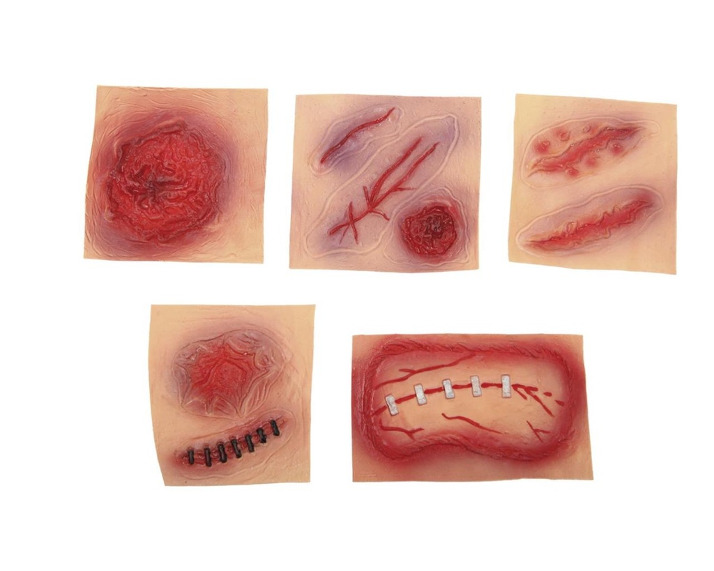 Cicatrices De Goma Mod1